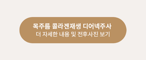 디어넥 링크